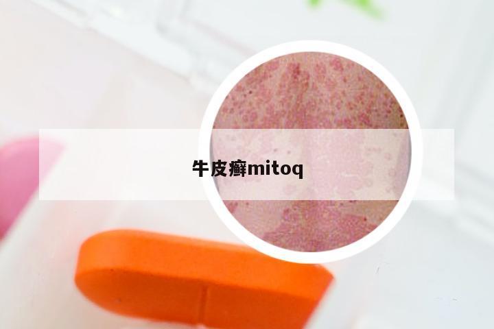 牛皮癣mitoq