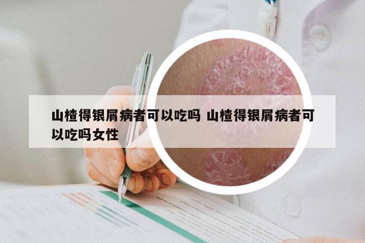 山楂得银屑病者可以吃吗 山楂得银屑病者可以吃吗女性