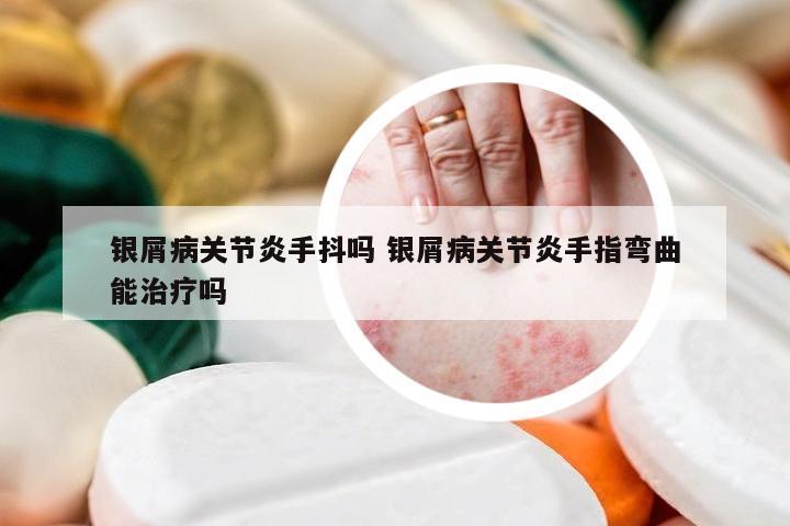银屑病关节炎手抖吗 银屑病关节炎手指弯曲能治疗吗