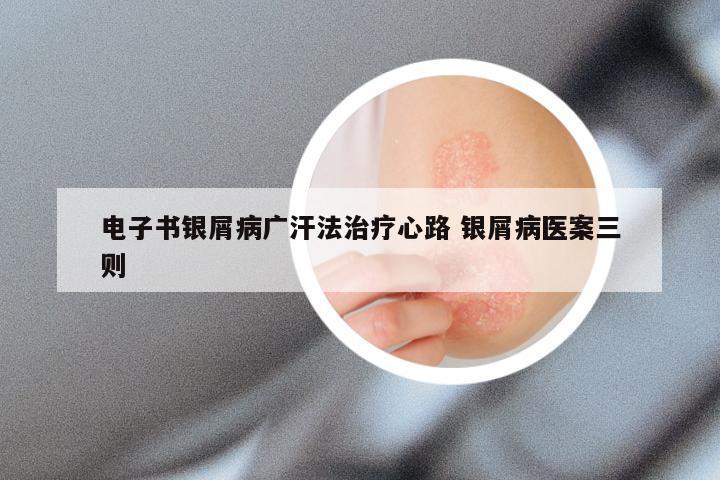 电子书银屑病广汗法治疗心路 银屑病医案三则