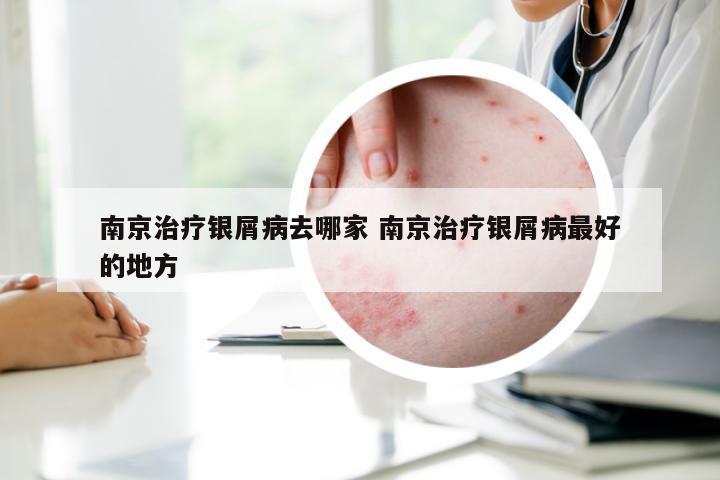 南京治疗银屑病去哪家 南京治疗银屑病最好的地方