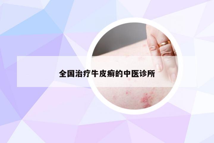 全国治疗牛皮癣的中医诊所