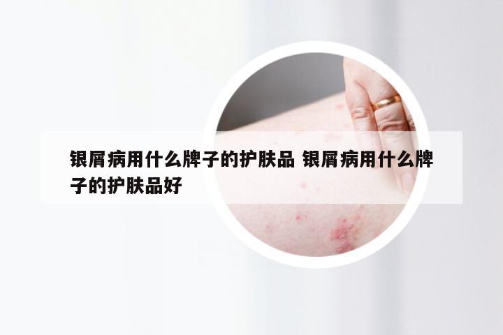 银屑病用什么牌子的护肤品 银屑病用什么牌子的护肤品好