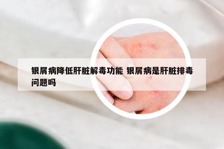 银屑病降低肝脏解毒功能 银屑病是肝脏排毒问题吗
