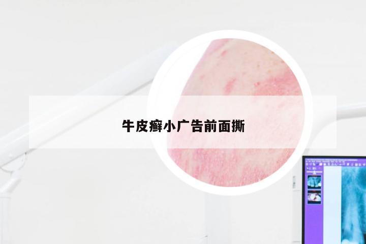 牛皮癣小广告前面撕