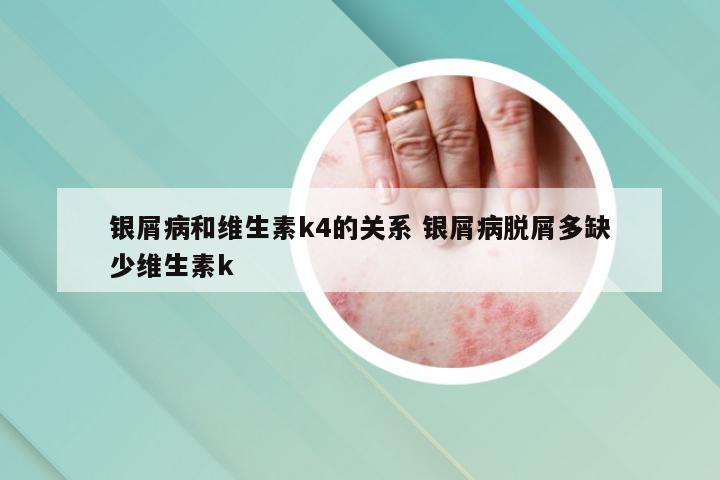 银屑病和维生素k4的关系 银屑病脱屑多缺少维生素k