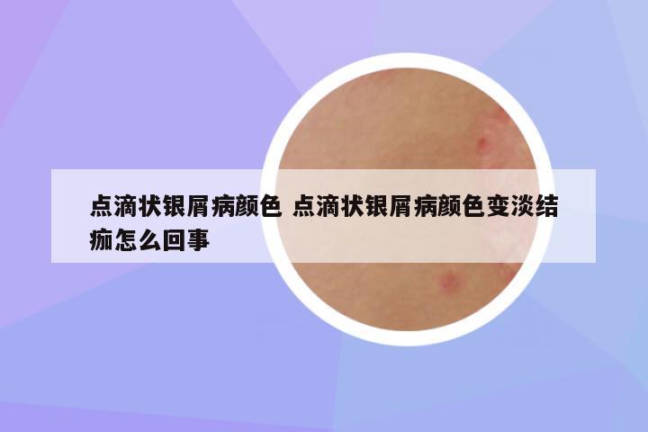 点滴状银屑病颜色 点滴状银屑病颜色变淡结痂怎么回事