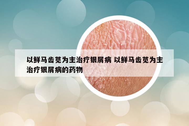 以鲜马齿苋为主治疗银屑病 以鲜马齿苋为主治疗银屑病的药物