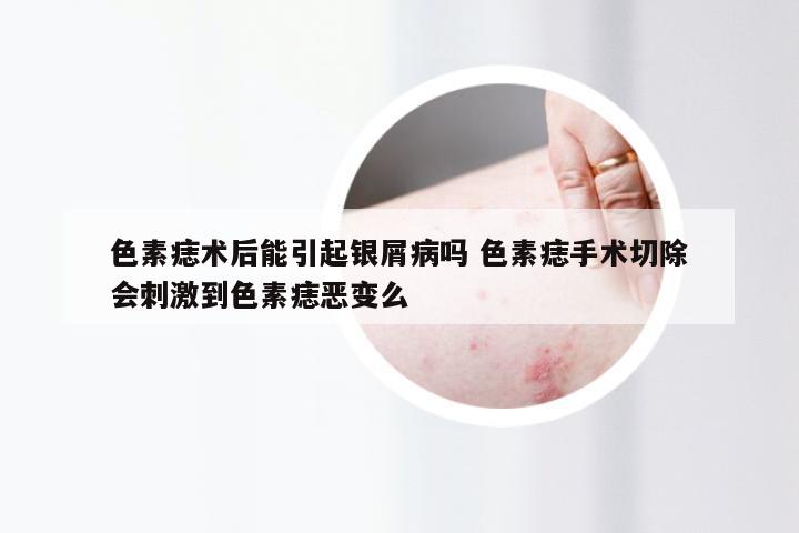 色素痣术后能引起银屑病吗 色素痣手术切除会刺激到色素痣恶变么