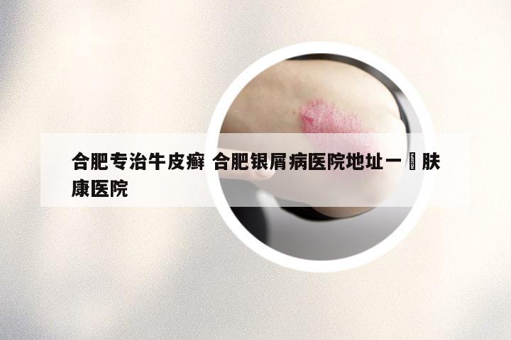 合肥专治牛皮癣 合肥银屑病医院地址一▪肤康医院