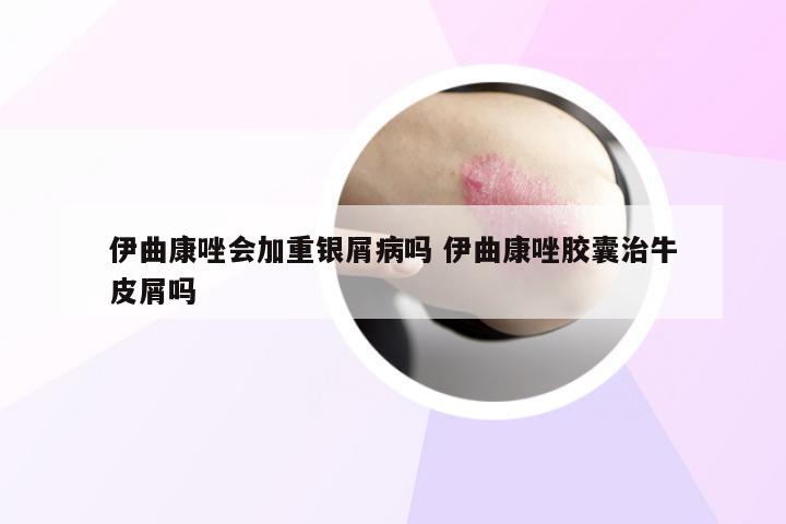 伊曲康唑会加重银屑病吗 伊曲康唑胶囊治牛皮屑吗