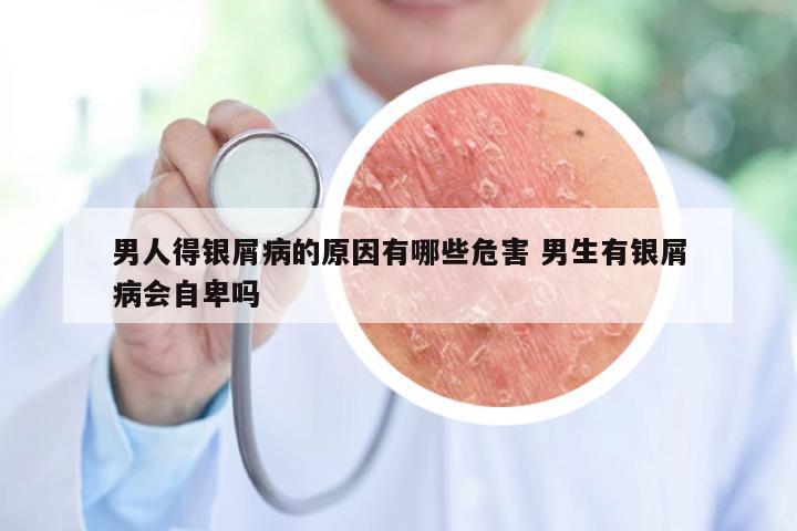 男人得银屑病的原因有哪些危害 男生有银屑病会自卑吗