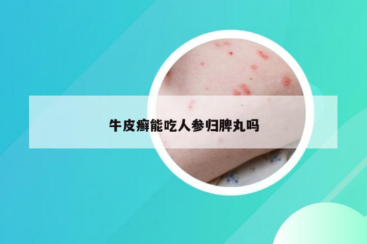 牛皮癣能吃人参归脾丸吗