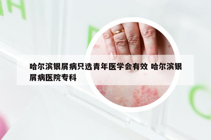 哈尔滨银屑病只选青年医学会有效 哈尔滨银屑病医院专科