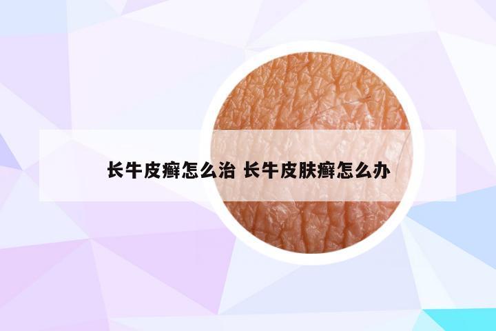 长牛皮癣怎么治 长牛皮肤癣怎么办