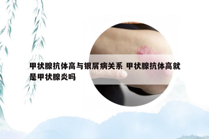 甲状腺抗体高与银屑病关系 甲状腺抗体高就是甲状腺炎吗