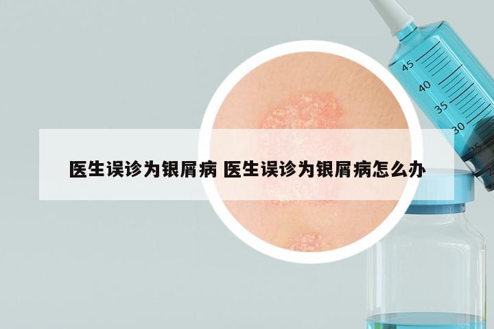医生误诊为银屑病 医生误诊为银屑病怎么办
