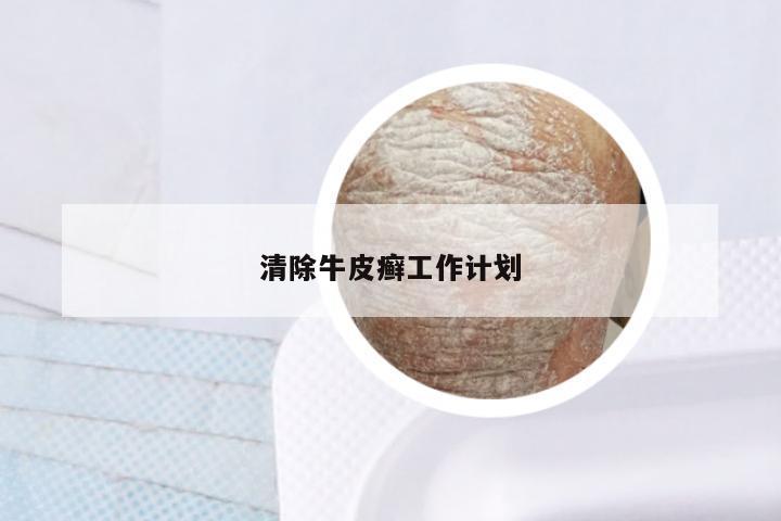 清除牛皮癣工作计划