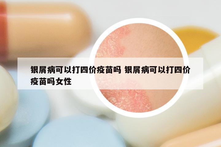 银屑病可以打四价疫苗吗 银屑病可以打四价疫苗吗女性