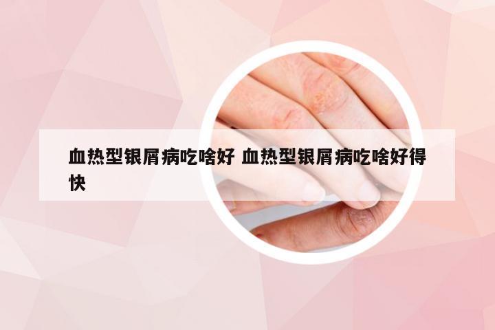 血热型银屑病吃啥好 血热型银屑病吃啥好得快