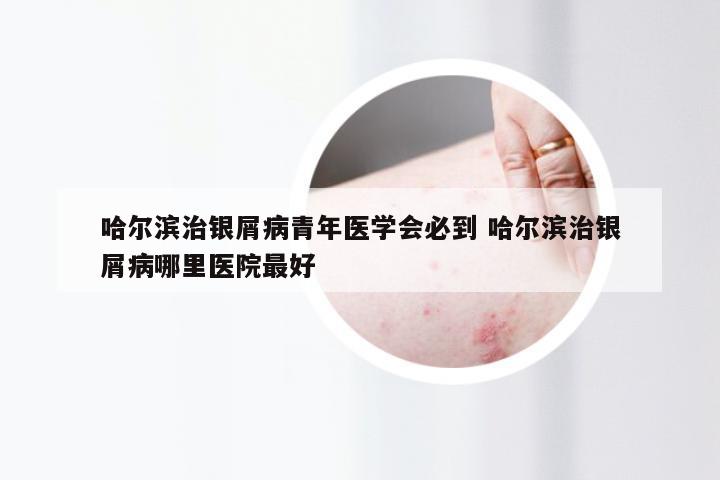 哈尔滨治银屑病青年医学会必到 哈尔滨治银屑病哪里医院最好