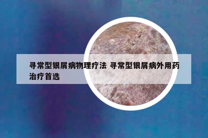 寻常型银屑病物理疗法 寻常型银屑病外用药治疗首选