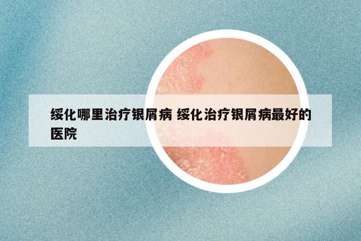 绥化哪里治疗银屑病 绥化治疗银屑病最好的医院