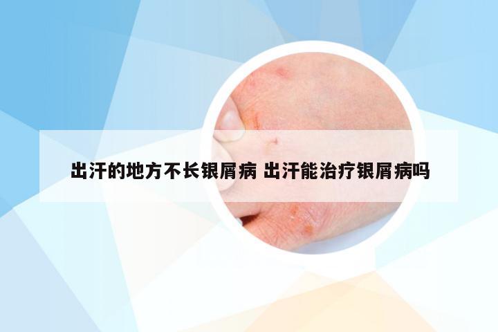 出汗的地方不长银屑病 出汗能治疗银屑病吗