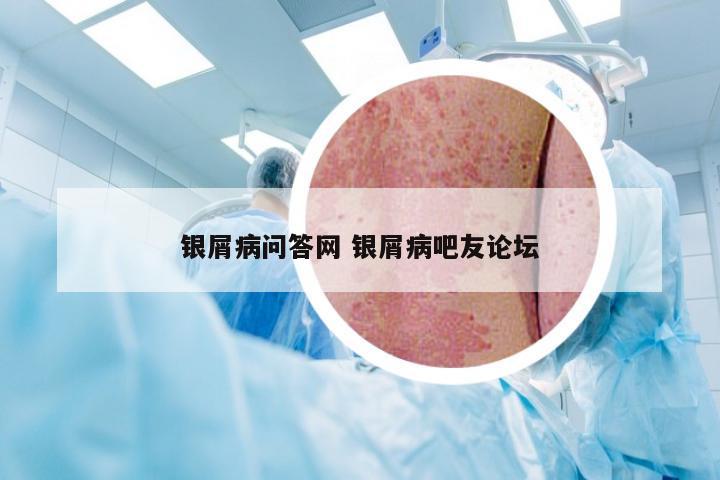 银屑病问答网 银屑病吧友论坛