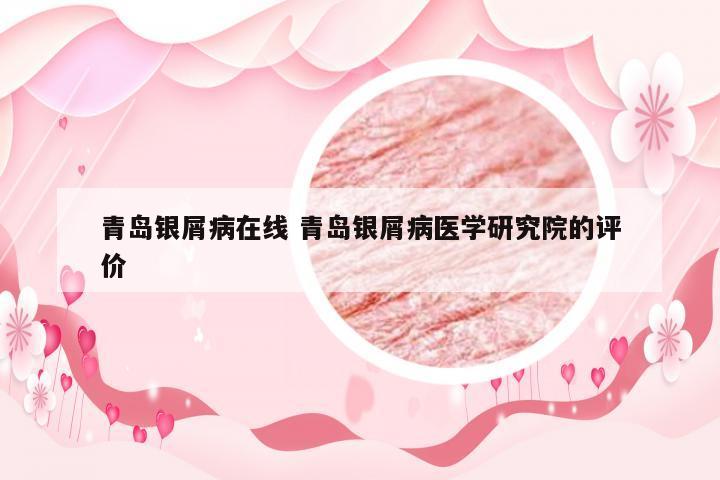 青岛银屑病在线 青岛银屑病医学研究院的评价