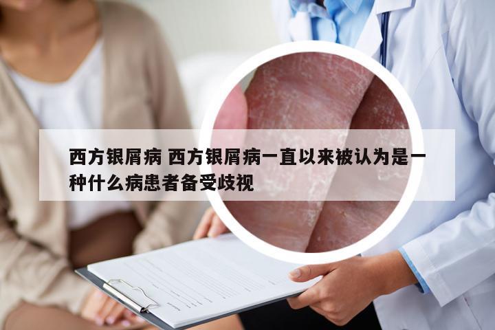 西方银屑病 西方银屑病一直以来被认为是一种什么病患者备受歧视