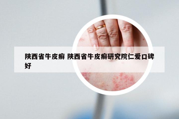 陕西省牛皮癣 陕西省牛皮癣研究院仁爱口碑好