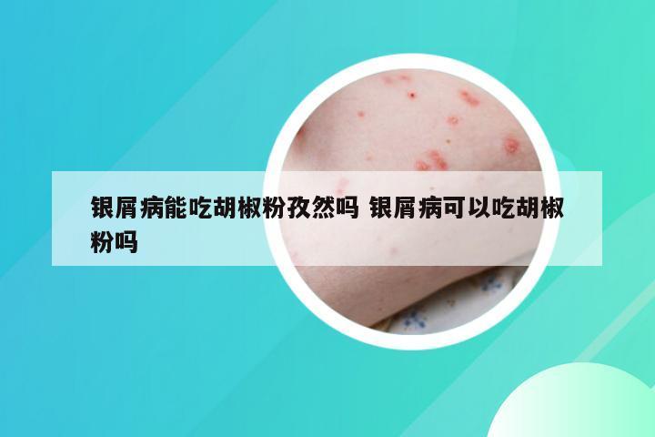 银屑病能吃胡椒粉孜然吗 银屑病可以吃胡椒粉吗