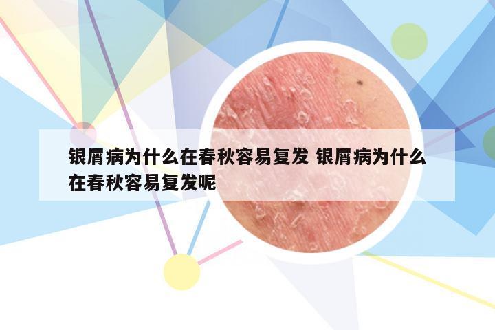 银屑病为什么在春秋容易复发 银屑病为什么在春秋容易复发呢
