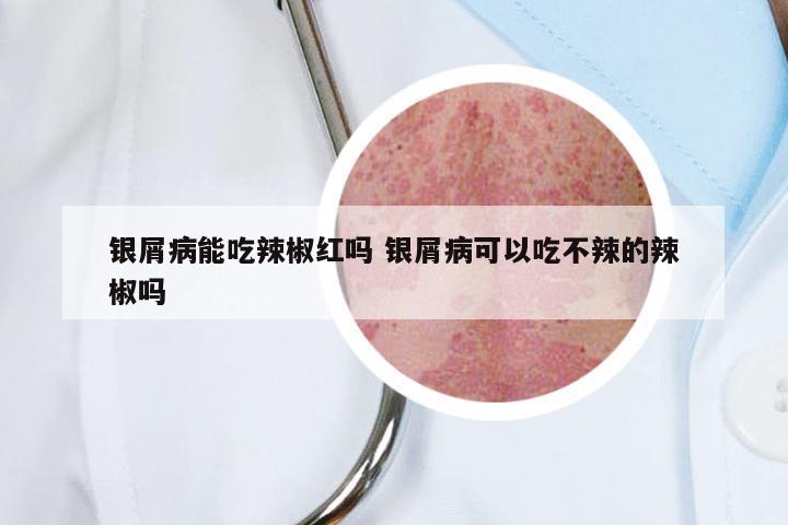 银屑病能吃辣椒红吗 银屑病可以吃不辣的辣椒吗