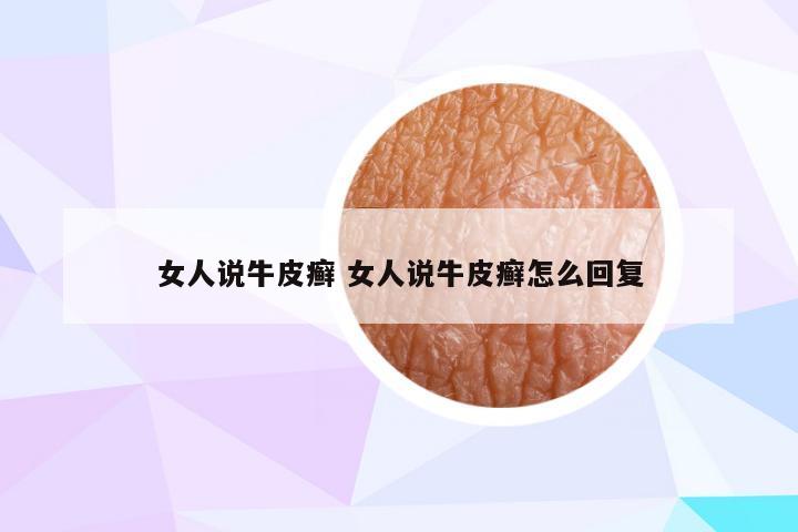 女人说牛皮癣 女人说牛皮癣怎么回复