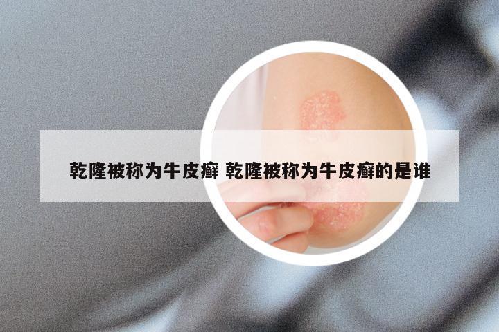 乾隆被称为牛皮癣 乾隆被称为牛皮癣的是谁