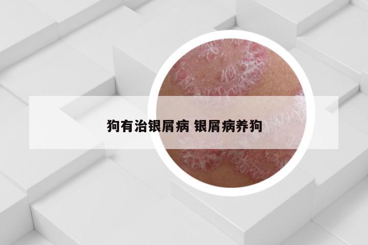 狗有治银屑病 银屑病养狗