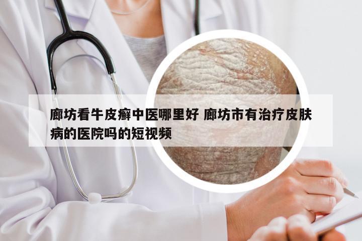 廊坊看牛皮癣中医哪里好 廊坊市有治疗皮肤病的医院吗的短视频