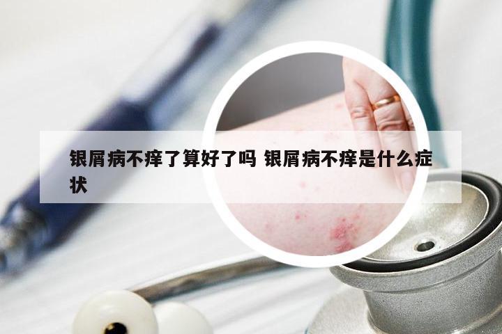 银屑病不痒了算好了吗 银屑病不痒是什么症状