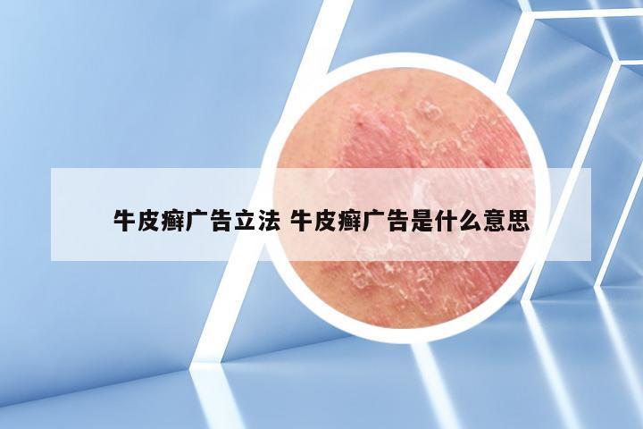 牛皮癣广告立法 牛皮癣广告是什么意思