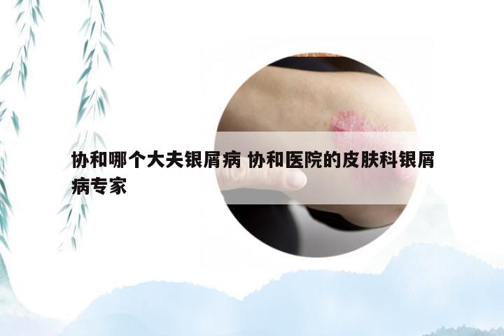 协和哪个大夫银屑病 协和医院的皮肤科银屑病专家