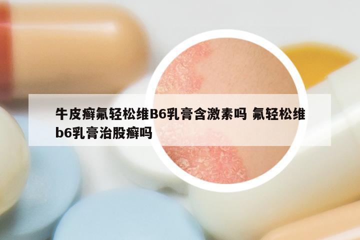 牛皮癣氟轻松维B6乳膏含激素吗 氟轻松维b6乳膏治股癣吗