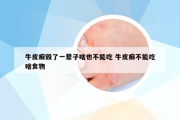 牛皮癣毁了一辈子啥也不能吃 牛皮癣不能吃啥食物