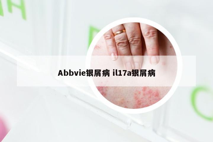 Abbvie银屑病 il17a银屑病