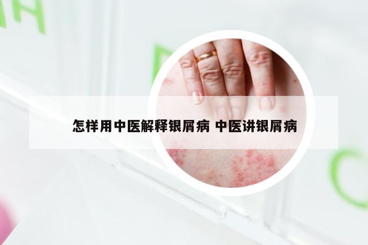 怎样用中医解释银屑病 中医讲银屑病