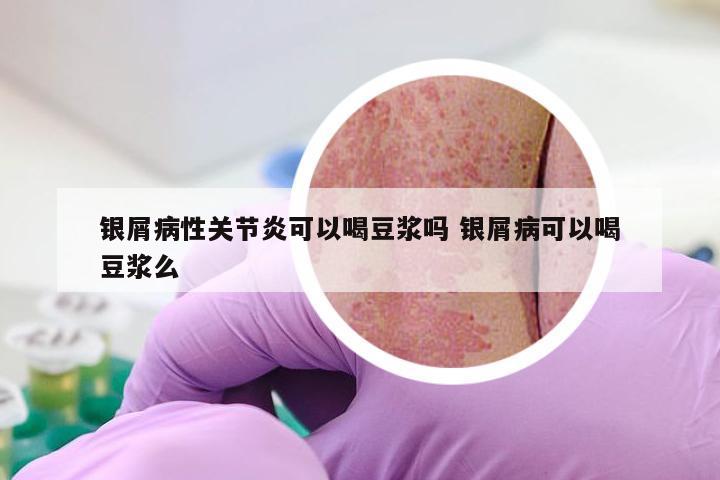 银屑病性关节炎可以喝豆浆吗 银屑病可以喝豆浆么