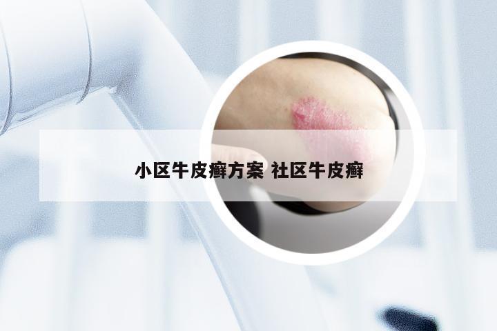 小区牛皮癣方案 社区牛皮癣