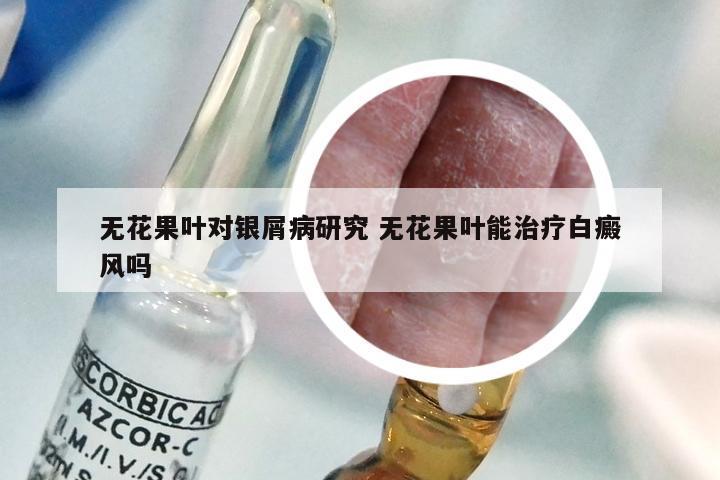 无花果叶对银屑病研究 无花果叶能治疗白癜风吗