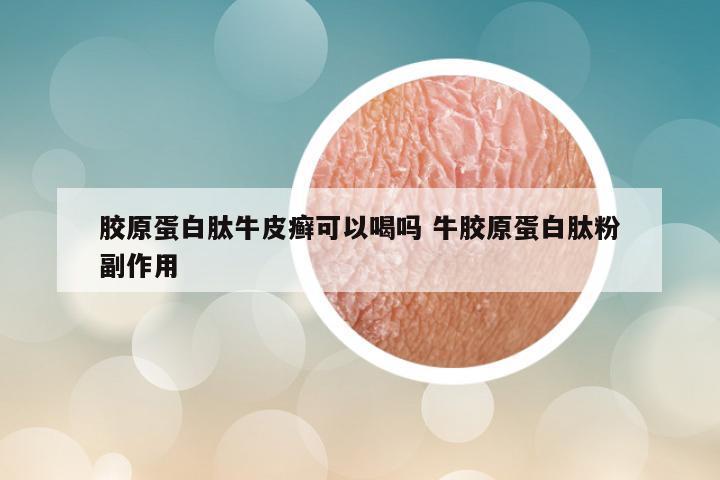 胶原蛋白肽牛皮癣可以喝吗 牛胶原蛋白肽粉副作用